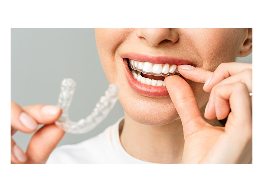  "Ortodoncia Online: ¿Un Riesgo para tu Sonrisa?"