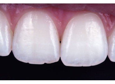 VITTRA APS: UNA RESINA A LA ALTURA DE SU EXIGENCIA