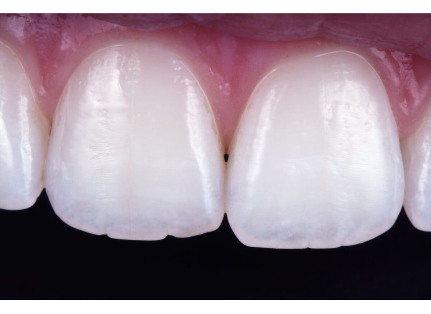 VITTRA APS: UNA RESINA A LA ALTURA DE SU EXIGENCIA